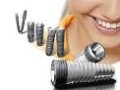 Идея применения имплантантов зубов 
